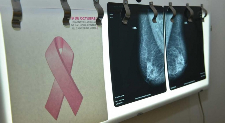0_mamografias.jpg